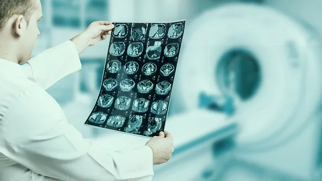 radioisotopos-medicos-lutecio-177-energia-nuclear