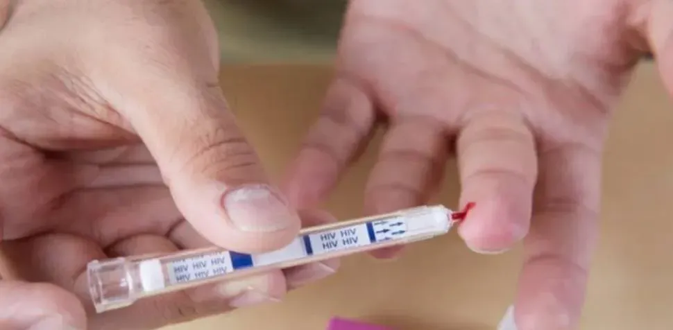 hiv
