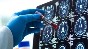 Un análisis de sangre podría detectar el Alzheimer antes de los primeros síntomas