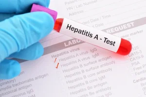 Hepatitis A: la confirmación de 34 nuevos casos pone a Argentina en zona de alerta