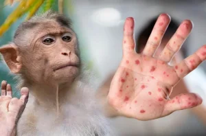 El Ministerio de Salud activó el protocolo epidemiológico y descartó la transmisión local del virus